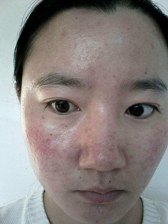 仟佰草面膜怎么样,非法添加激素被质检总局曝光 面膜激素 第3张 仟佰草面膜怎么样,非法添加激素被质检总局曝光 面膜激素 第3张