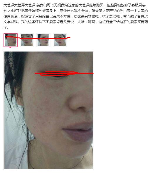 樊文花面膜怎么样，樊文花面膜有激素吗 是否容易过敏  樊文花面膜激素 第3张