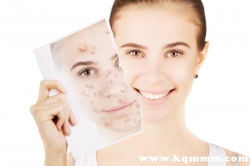 去痤疮面膜敷多长时间，面部痤疮可以敷面膜吗