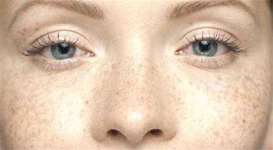 曲中周祛斑是真的可以去掉斑吗  曲中周 祛斑 美白祛黄 第2张