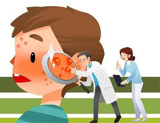 脸上玫瑰痤疮治疗方法都有什么