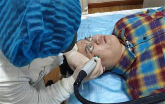 脸上玫瑰痤疮治疗方法都有什么  玫瑰痤疮 美白祛黄 第3张