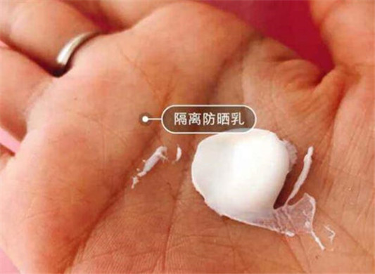 脸上玫瑰痤疮治疗方法都有什么  玫瑰痤疮 美白祛黄 第4张