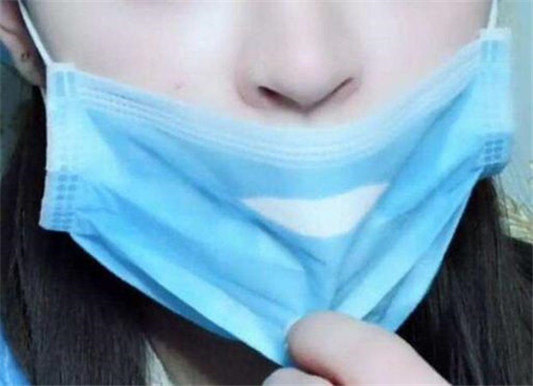 戴口罩下巴长一堆疙瘩怎么办  戴口罩 美白祛黄 第4张