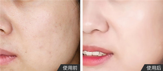 韩束红BB霜怎么样，价格是否防晒，韩束红BB霜需要卸妆吗  韩束 BB霜 粉底 遮瑕 第4张