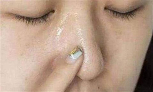 如何去掉黑头  黑头 水油平衡 第2张