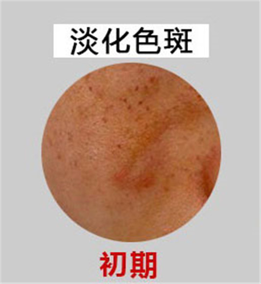 莉莎度美白祛斑霜效果好不好，价格是多少  祛斑霜 美白 第2张