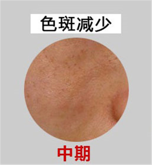 莉莎度美白祛斑霜效果好不好，价格是多少  祛斑霜 美白 第3张