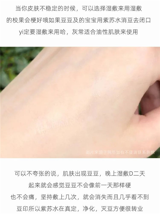 消除闭口的小霸王爽肤水，油皮亲妈，闭口克星来啦  爽肤水 化妆水 第15张