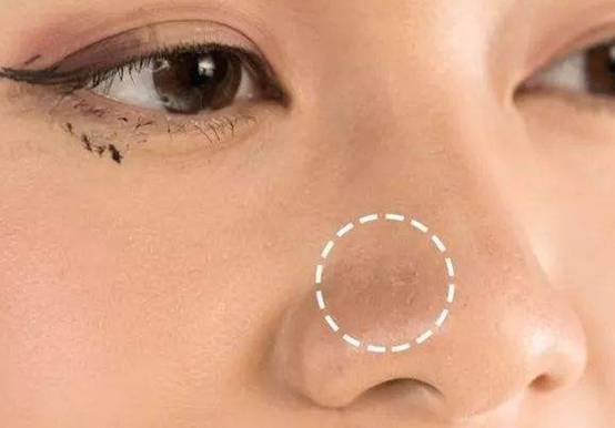 毛孔粗大怎么化妆不卡粉 卡粉 毛孔粗大 美妆 第1张