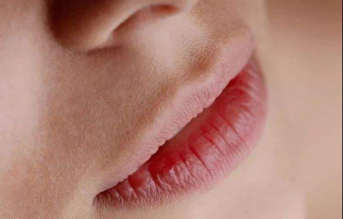 孕妇嘴唇干裂脱皮怎么办 嘴唇 嘴唇干裂 美妆 第1张