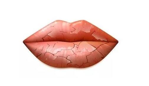 秋冬季嘴唇裂口脱皮怎么办 嘴唇 嘴唇干裂 美妆 第1张
