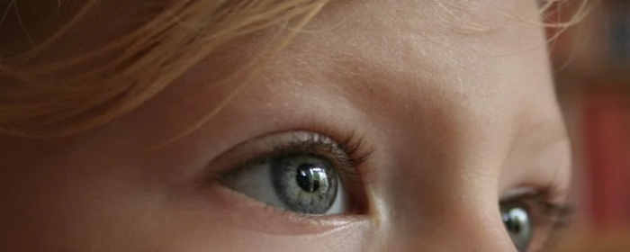 什么祛痘最快最有效 祛痘 美妆 第3张 什么祛痘最快最有效 祛痘 美妆 第3张