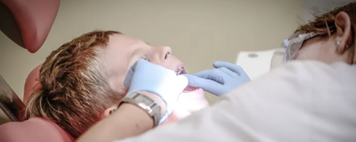 怎么使牙齿变白 使牙齿变白 美妆 第3张