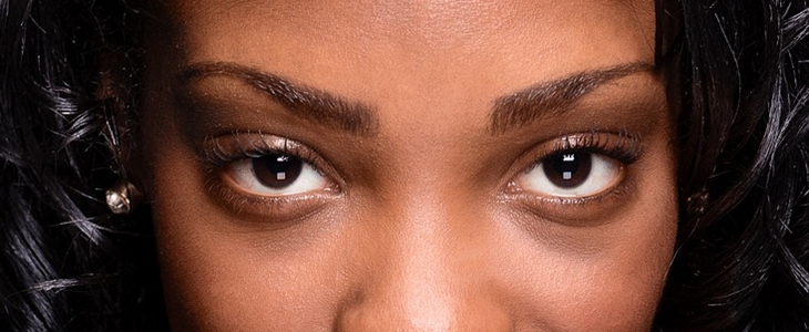 黑眼圈和眼袋的区别 黑眼圈 眼袋 美妆 第3张