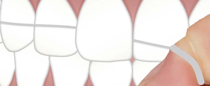 美白牙齿小妙招 美白牙齿 美妆 第2张