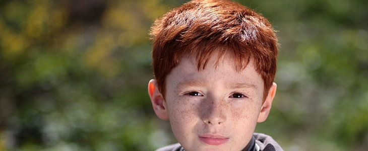 黄褐斑能自己消退吗 黄褐斑 美妆 第3张