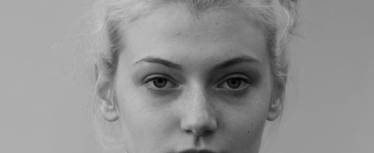 左下巴长痘痘是什么原因 左下巴 痘痘 美妆 第3张