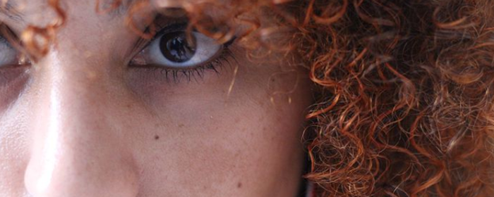 长黄褐斑是什么原因 长黄褐斑 美妆 第1张