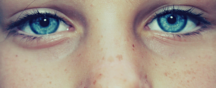 黄褐斑怎么回事 黄褐斑 美妆 第1张