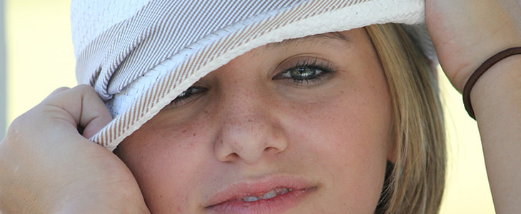 脸上的斑怎么去除 脸 斑 去除 美妆 第3张