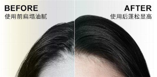 细软塌星人自救指南，王炸洗发水让你随意蓬蓬蓬 头发 洗发 资讯 第4张