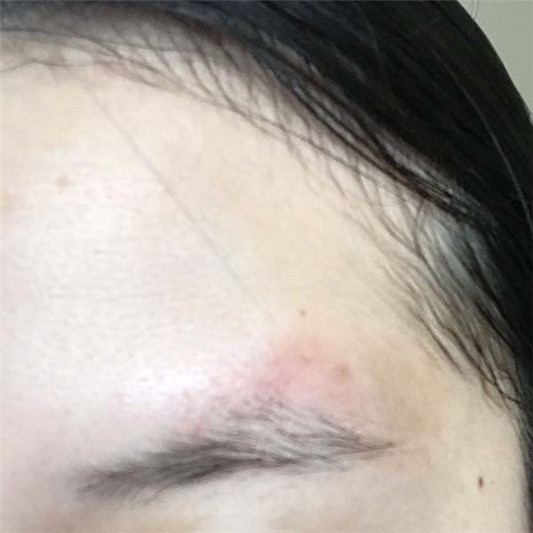 薇诺娜舒敏保湿修护精华液使用评测 薇诺娜 精华 第6张