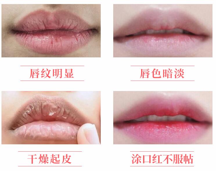 嘴唇干裂开口好疼怎么办 唇部干掉皮护唇方法 好物推荐 嘴唇干裂开口好疼怎么办 唇部干掉皮护唇方法 好物推荐
