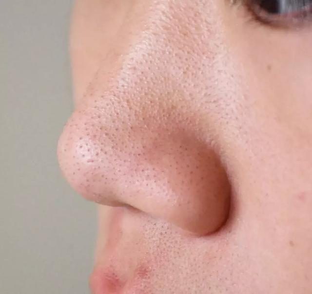 值得回购的清洁面膜有哪些 黑头 清洁 清洁面膜 美容 第7张