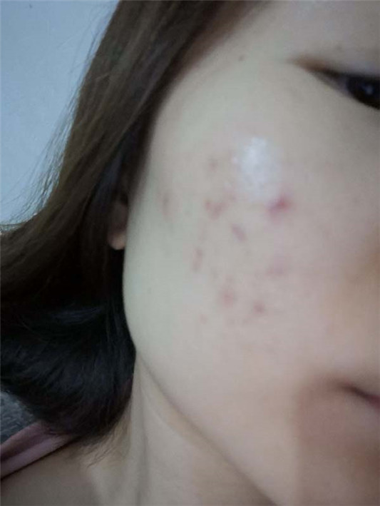 悦木之源菌菇水怎么样,悦木之源菌菇水使用测评 悦木之源 菌菇水 第5张 悦木之源菌菇水怎么样,悦木之源菌菇水使用测评 悦木之源 菌菇水 第5张