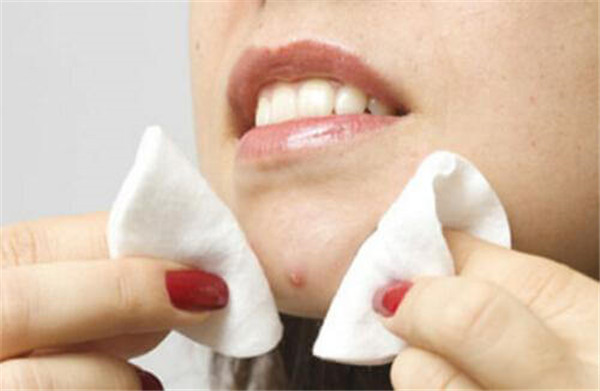 下巴痛有硬块怎么回事 护肤 第4张