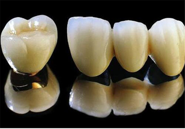 烤瓷牙怎么取下来 护肤 第2张 烤瓷牙怎么取下来 护肤 第2张