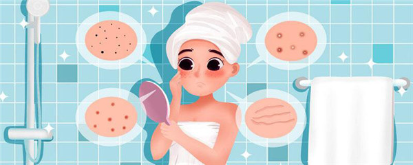 额头红色痘痘怎么消掉，额头长痘能不能化妆 护肤 第1张