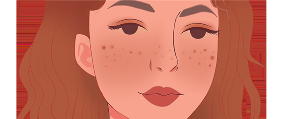 脸上长斑能用刮痧板刮吗,脸上长斑用刮痧板怎么刮 护肤 第1张 脸上长斑能用刮痧板刮吗,脸上长斑用刮痧板怎么刮 护肤 第1张