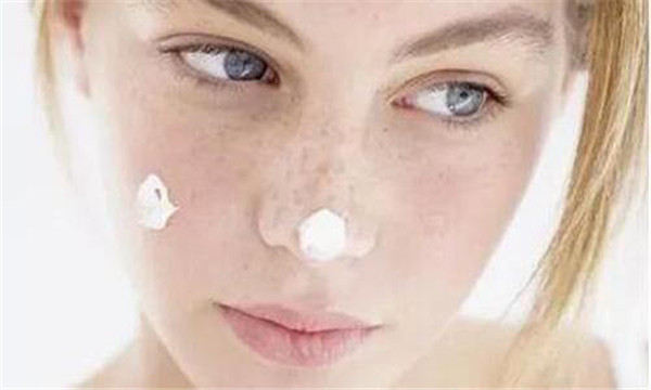 为什么女人会长黄褐斑 护肤 第2张 为什么女人会长黄褐斑 护肤 第2张