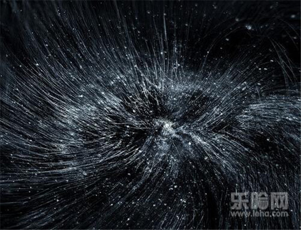 怎么去头屑又快又好 护肤 第1张