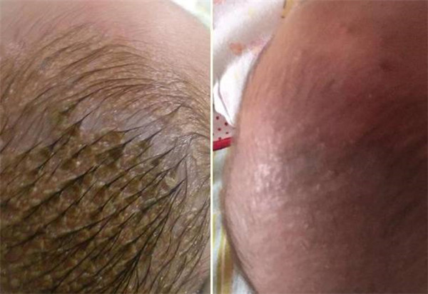 橄榄油去头垢正确方法是怎么样的 橄榄油 橄榄油去头垢 美妆 第2张