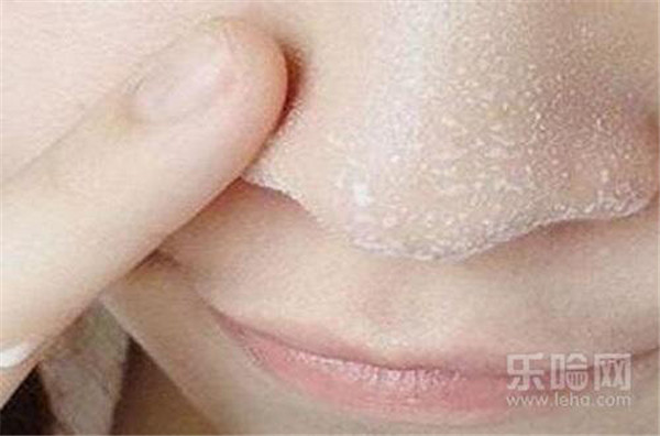 盐水洗脸可以祛痘吗  护肤 第5张