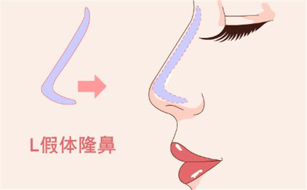 鼻头鼻翼如何缩小，鼻头鼻翼缩小效果明显吗 鼻头 鼻翼 第2张