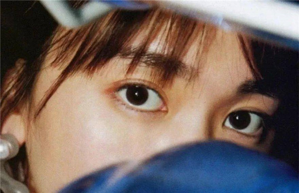 如何选择合适的双眼皮类型，双眼皮的种类 双眼皮 第19张