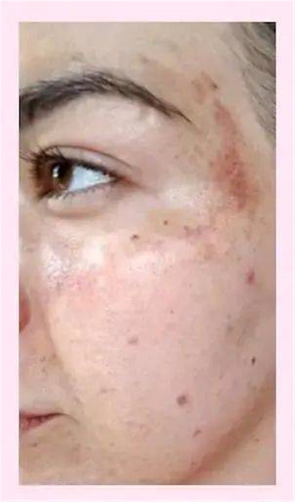 什么是大麻护肤，CBD解锁全新护肤方式 护肤 CBD 第22张