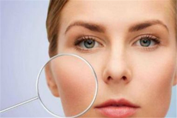 改善毛孔粗大要做好控油和清洁，补充水分防止皮肤干燥 改善 毛孔粗大 第3张