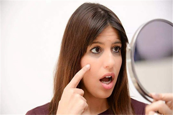 改善黑眼圈做好防晒，阻断黑色素的产生减缓自由基扩散 黑眼圈 防晒 第3张