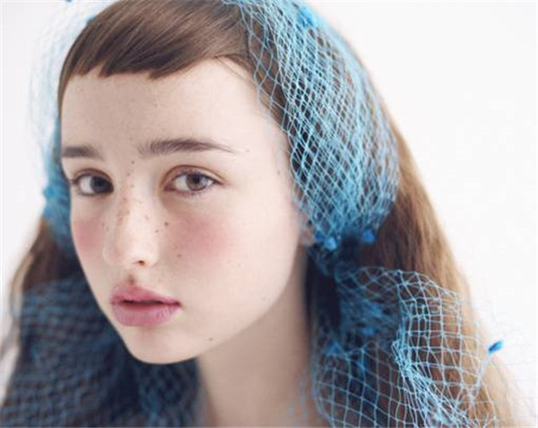 引起雀斑的因素：新陈代谢缓慢或紫外线照射 雀斑 因素 第1张