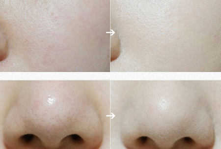 蒂佳婷银管使用方法，​蒂佳婷银管bb适合什么肤质