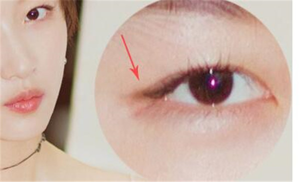 晕晕线有什么作用，​晕晕线怎么画