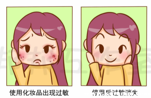 化妆品过敏了怎么快速脱敏，化妆品过敏脸上红肿发痒如何处理