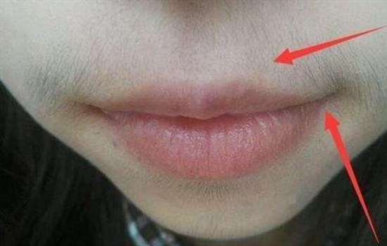 牙膏和盐可以去唇毛吗，跟小毛孩说拜拜