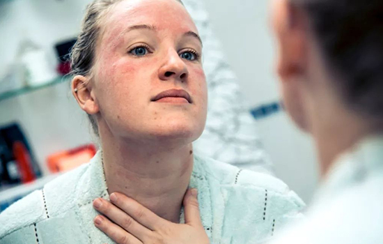 夏天皮肤油腻怎么办