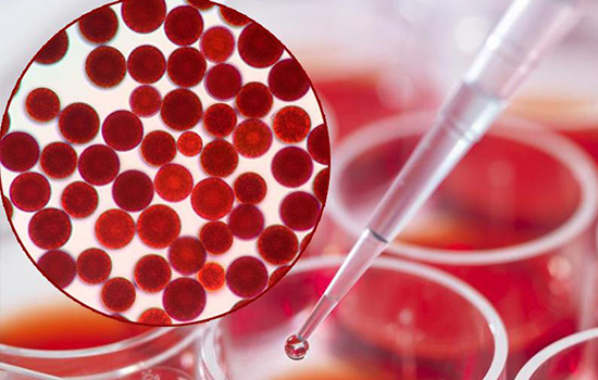 虾青素白天可以用吗，虾青素原液的作用